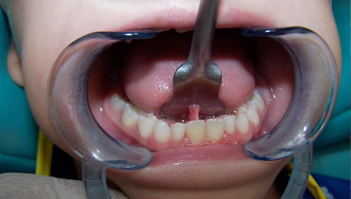 Chirurgia pedodontica